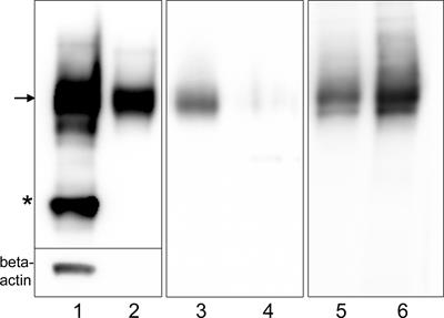 Patients’ IgLON5 autoantibodies interfere with IgLON5-protein interactions